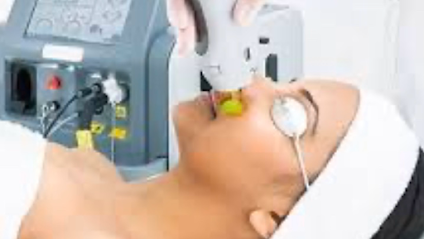 Laser Concept Epilation, Cryolipolyse Et Peelings, Centre D'épilation à Saint-Gratien
